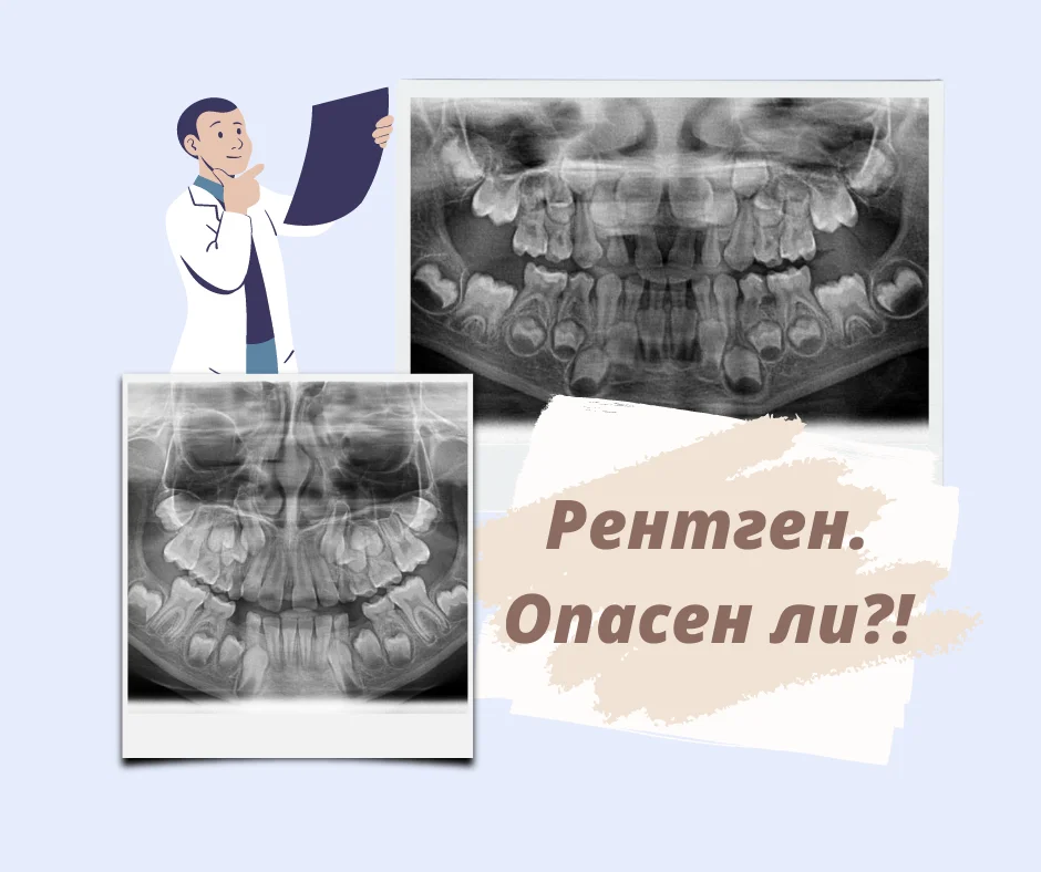 Рентген в стоматологии. Опасен ли?