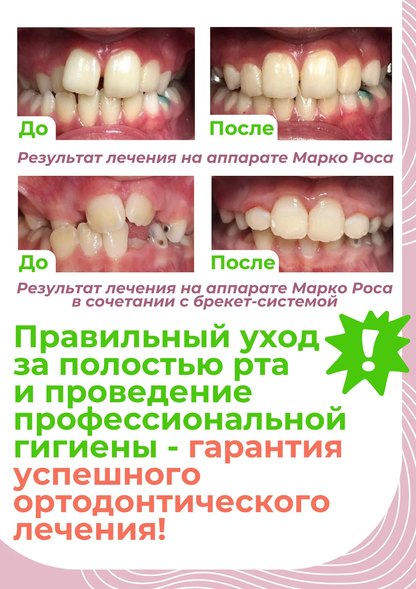 до/после до/после