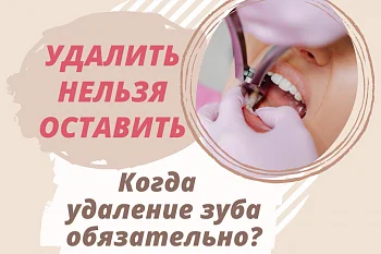 Когда удаление зуба обязательно? Когда удаление зуба обязательно?