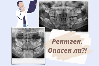 Рентген в стоматологии. Опасен ли? Рентген в стоматологии. Опасен ли?
