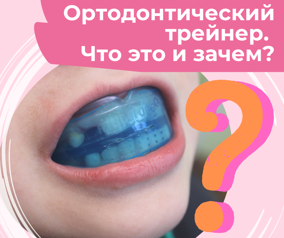 Ортодонтический трейнер. Что это и зачем?