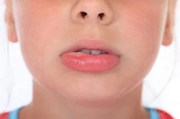 Опухли половые губы и зуд: причины